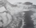 Thumbnail for version as of 03:09, 7 March 2011